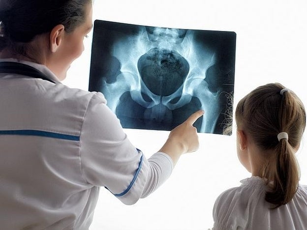 Las secuelas de las enfermedades reumáticas infantiles