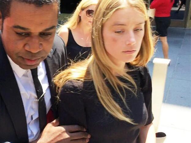 Amber Heard muestra su rostro herido