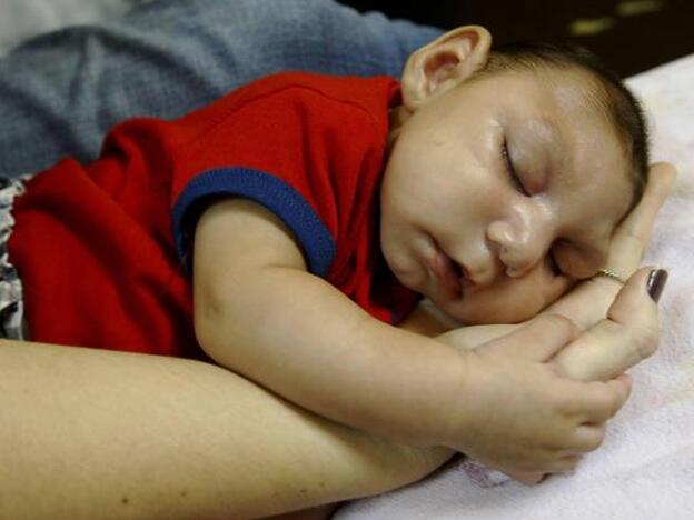 Nace en España el primer bebé con microcefalia por contagio del virus zika