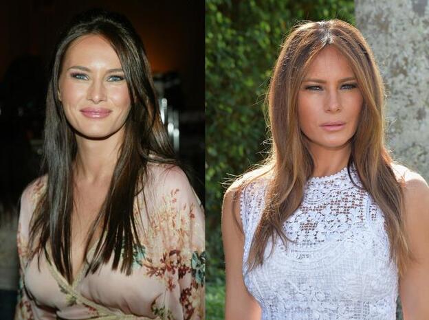 Los retoques estéticos de Melania Trump