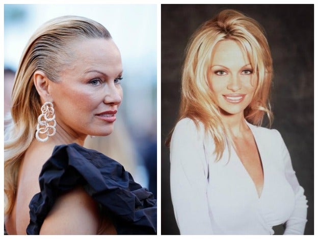 ¿Pamela Anderson está obsesionada con la cirugía estética?