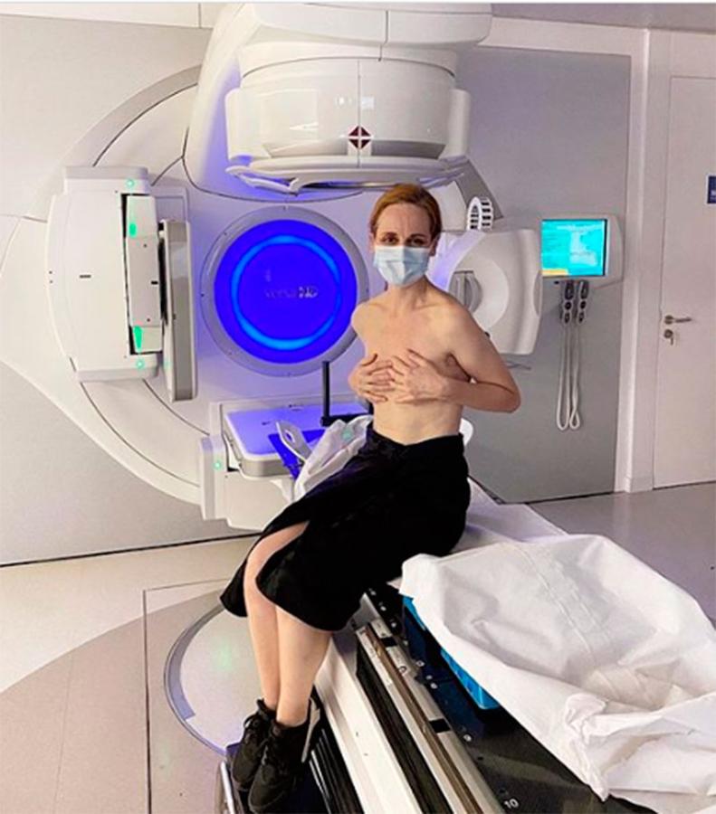 Famosas que han ganado la batalla al cáncer de mama: de Ana Locking a Kylie Minogue