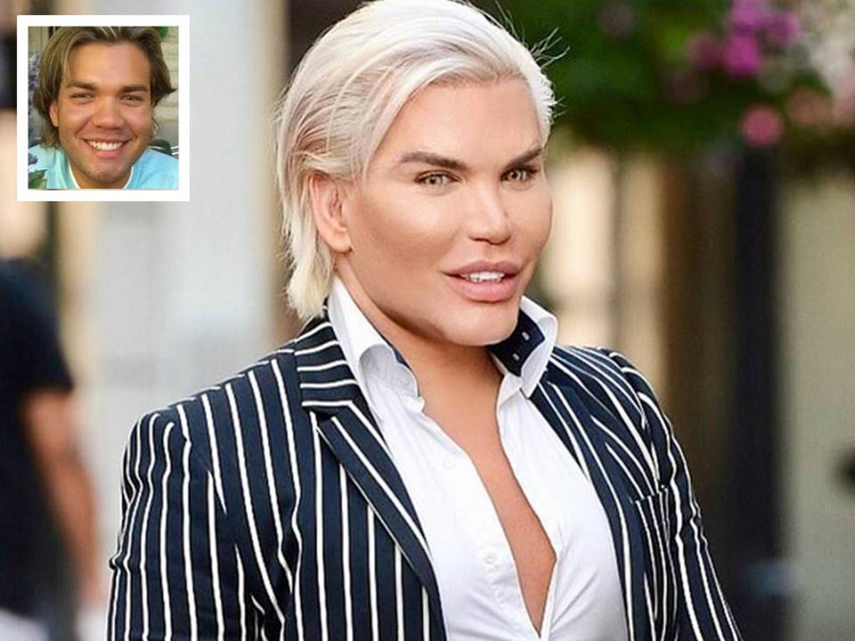 El Ken humano se opera de nuevo (y otros adictos al bisturí)