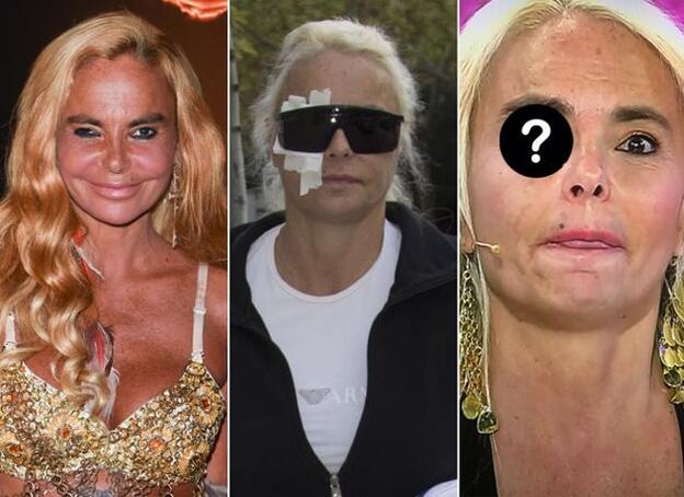 Leticia Sabater termina con el 'ojo rebelde': el resultado de su operación