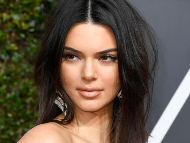 ¿Por qué es importante que Kendall Jenner no oculte su acné?