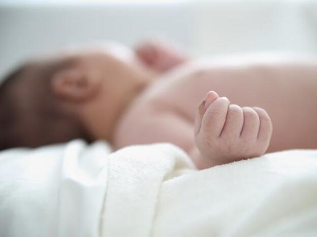 Dermatitis seborreica en bebés o costra láctea