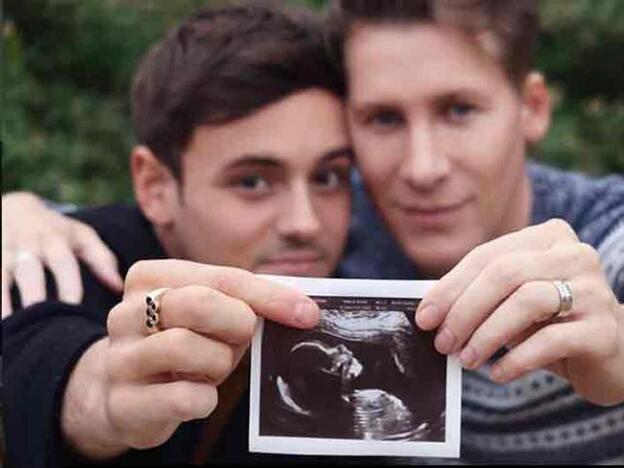 Tom Daley y Dustin Lance Blakc muestran la ecografía de su bebé./instagram.