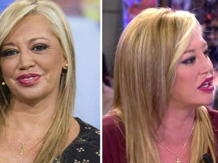 El antes y el después de los famosos que se han retocado la cara