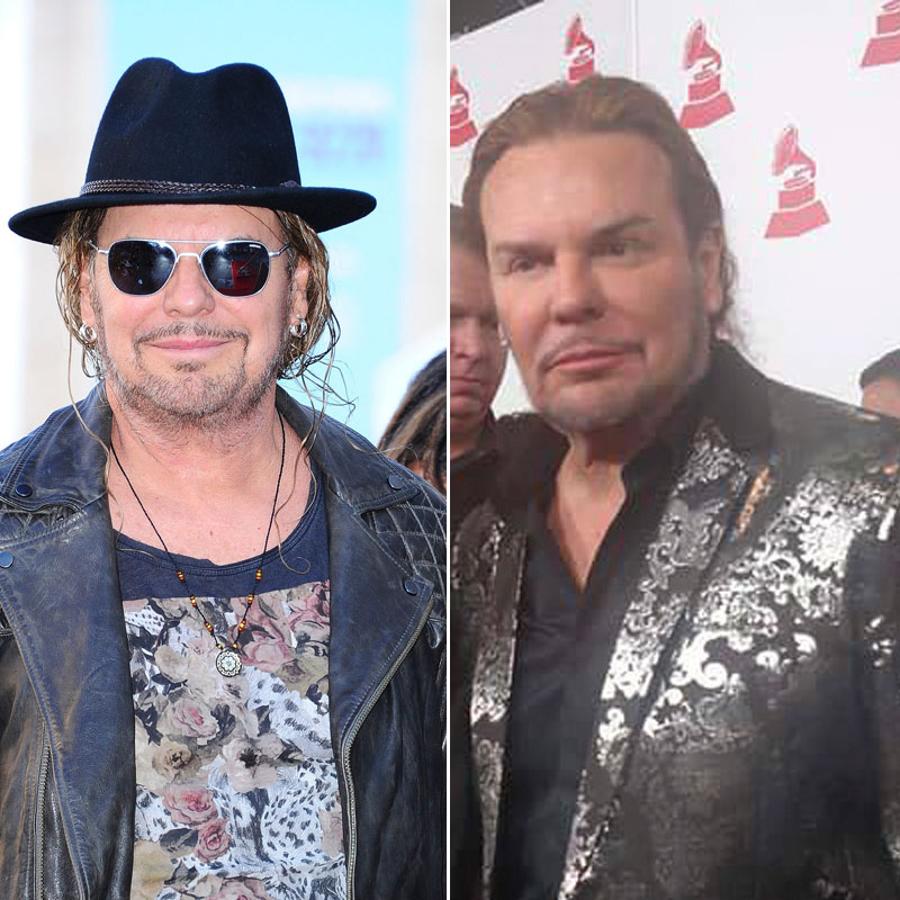 El antes y el después de los famosos que se han retocado la cara