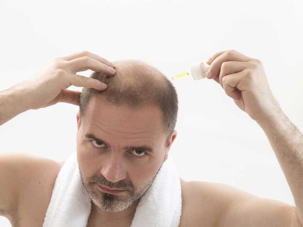 ¿Cómo luchar contra la alopecia?