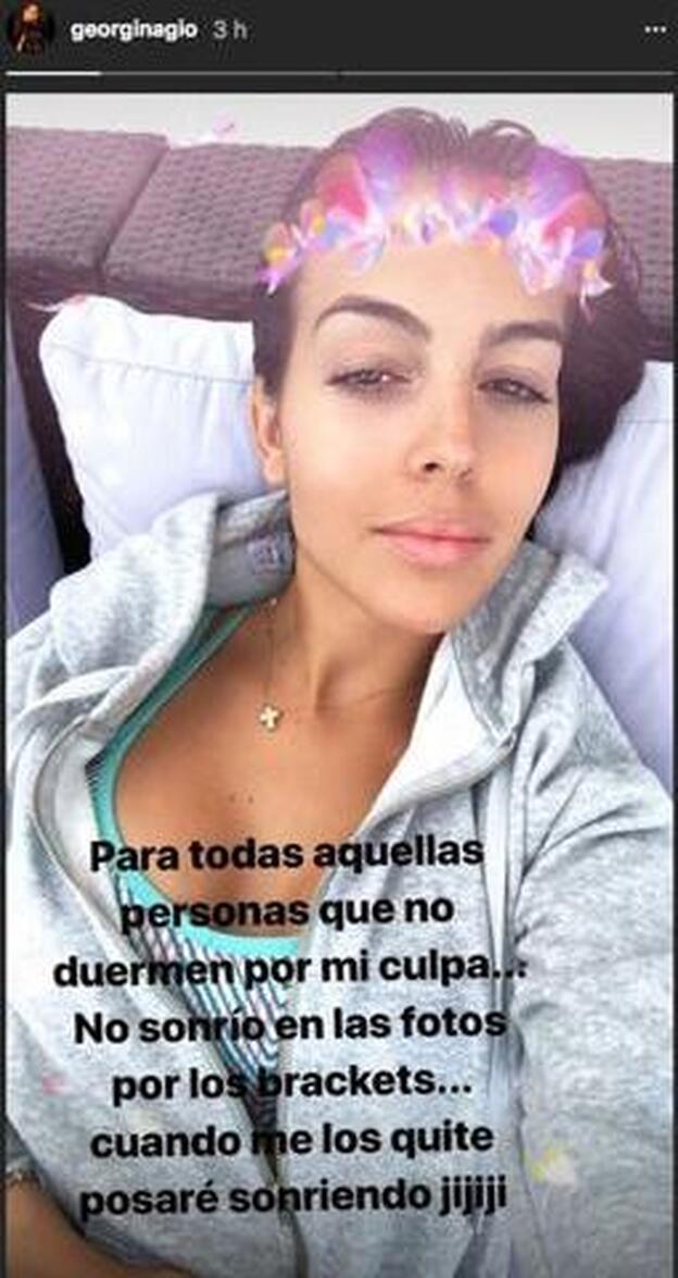 La imagen con la que Georgina explica por qué no sonríe en las fotos.