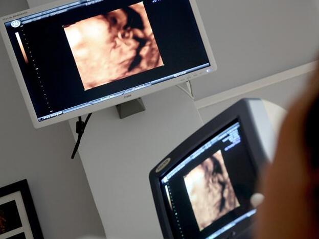 Semana 31 de embarazo: el bebé se prepara para salir