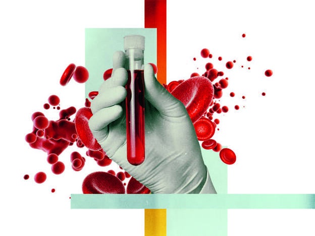 Cómo intrepertar los análisis de sangre