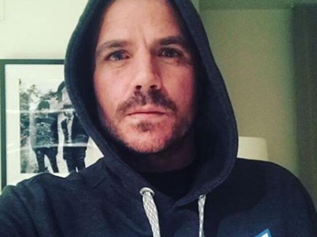 Dani Martín confiesa que tiene rosácea