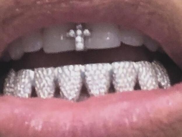 Nueva excentricidad: llevar diamantes en los dientes