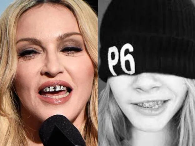 Madonna y Cara Delevingne con diamantes en los dientes.