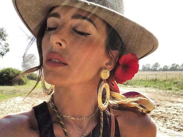 El producto clave con el que Rocío Osorno dijo adiós al acné en su rostro