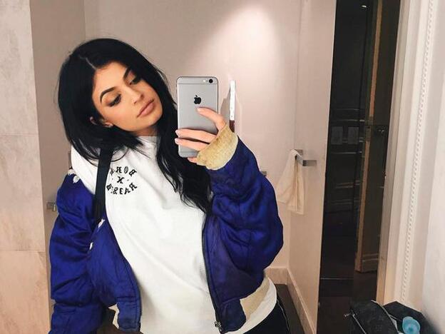 La verdad sobre los retoques estéticos de Kylie Jenner