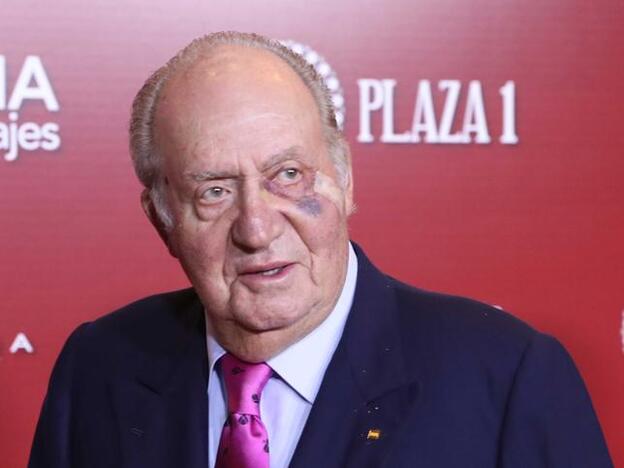 El motivo del moratón del Rey Juan Carlos