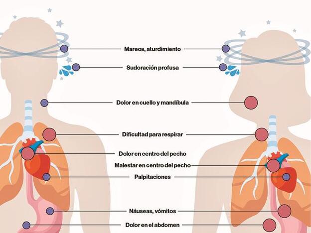 ¿Cuáles son los síntomas de un infarto en una mujer?