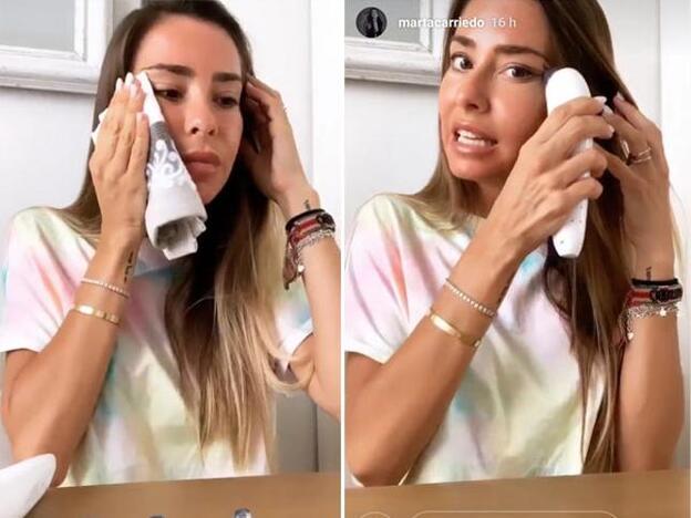 Marta Carriedo ha mostrado en sus stories de Instagram su secreto para acabar con los puntos negros y las primeras líneas de expresión en el rostro.