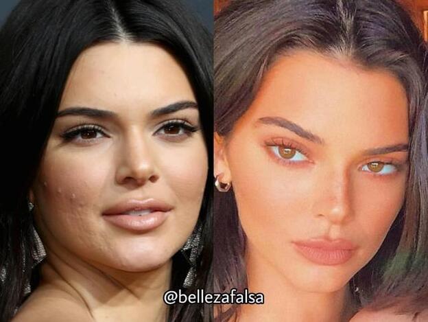 Celulitis, flacidez, acné... Estos perfiles de Instagram muestran la realidad de las famosas con imágenes sin photoshop