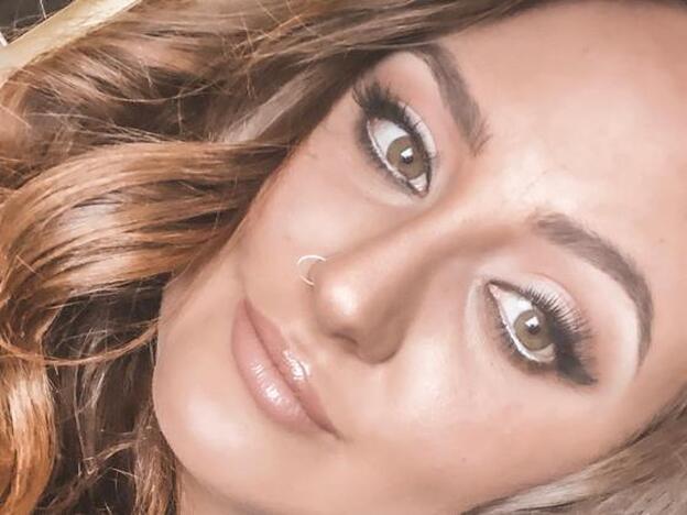 ¿Qué se ha hecho en la cara Rocío Flores que está irreconocible (y muy guapa)?