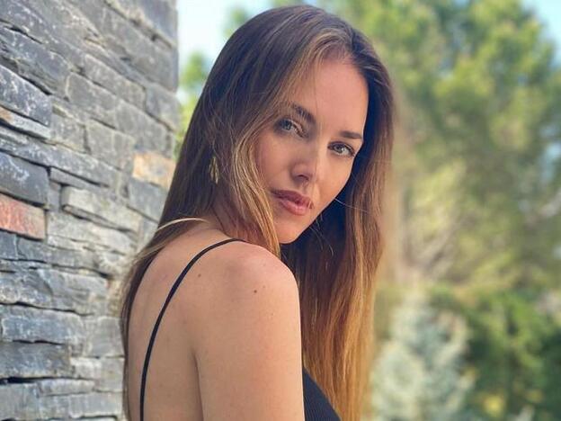 Helen Lindes también se hace el tratamiento favorito de las famosas e influencers para lucir una piel lisa y sin arrugas