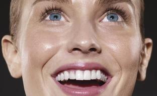 Trucos y tratamientos de profesional para tener los dientes más blancos y una sonrisa perfecta