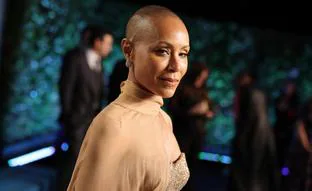 Qué es y qué diagnóstico tiene la alopecia, la enfermedad que padece la mujer de Will Smith, Jada Pinkett (y que ha provocado el incidente del bofetón en los Óscar)