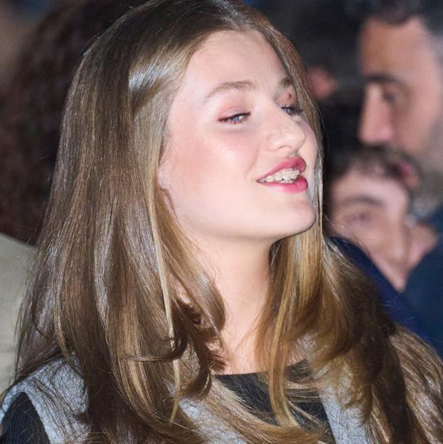 Qué se ha hecho Blanca Suárez en la sonrisa: el antes y el después del retoque estético favorito de las famosas